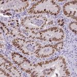 SATB2 Antibody in Immunohistochemistry (Paraffin) (IHC (P))