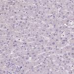SATB2 Antibody in Immunohistochemistry (Paraffin) (IHC (P))