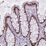 SATB2 Antibody in Immunohistochemistry (Paraffin) (IHC (P))