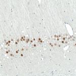 SATB2 Antibody in Immunohistochemistry (Paraffin) (IHC (P))