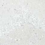 SATB2 Antibody in Immunohistochemistry (Paraffin) (IHC (P))