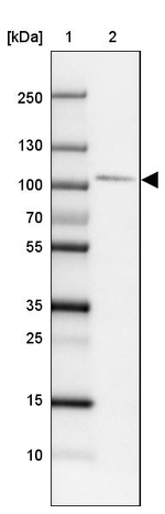 SATB2 Antibody in Western Blot (WB)