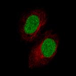 GDF15 Monoclonal Antibody (CL0328)