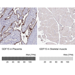 GDF15 Antibody in Immunohistochemistry (Paraffin) (IHC (P))