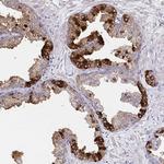 GDF15 Antibody in Immunohistochemistry (Paraffin) (IHC (P))