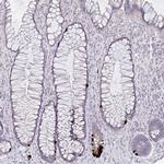 GDF15 Antibody in Immunohistochemistry (Paraffin) (IHC (P))