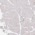 GDF15 Antibody in Immunohistochemistry (Paraffin) (IHC (P))