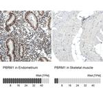 PBRM1 Antibody