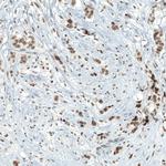 PBRM1 Antibody in Immunohistochemistry (Paraffin) (IHC (P))