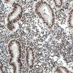 PBRM1 Antibody in Immunohistochemistry (Paraffin) (IHC (P))