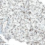 PBRM1 Antibody in Immunohistochemistry (Paraffin) (IHC (P))