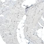 PBRM1 Antibody in Immunohistochemistry (Paraffin) (IHC (P))