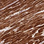 SDHB Antibody in Immunohistochemistry (Paraffin) (IHC (P))