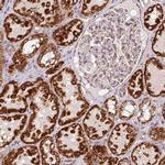 SDHB Monoclonal Antibody (CL0346)