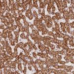 SDHB Antibody in Immunohistochemistry (Paraffin) (IHC (P))
