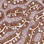 SDHB Antibody in Immunohistochemistry (Paraffin) (IHC (P))