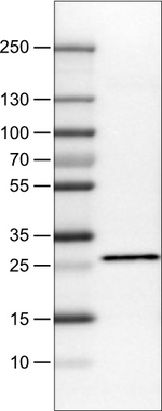 SDHB Antibody in Western Blot (WB)
