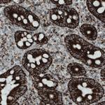 SDHB Antibody in Immunohistochemistry (Paraffin) (IHC (P))