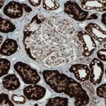 SDHB Antibody in Immunohistochemistry (Paraffin) (IHC (P))