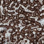 SDHB Antibody in Immunohistochemistry (Paraffin) (IHC (P))