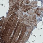 SDHB Antibody in Immunohistochemistry (Paraffin) (IHC (P))