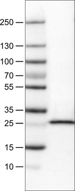 SDHB Antibody in Western Blot (WB)