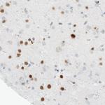 MEF2C Antibody in Immunohistochemistry (Paraffin) (IHC (P))