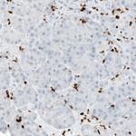 MEF2C Antibody in Immunohistochemistry (Paraffin) (IHC (P))