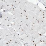 MEF2C Antibody in Immunohistochemistry (Paraffin) (IHC (P))