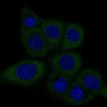 Dicer Monoclonal Antibody (CL0378)