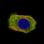 PHGDH Monoclonal Antibody (CL0555)