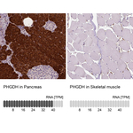 PHGDH Antibody in Immunohistochemistry (Paraffin) (IHC (P))