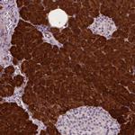 PHGDH Antibody in Immunohistochemistry (Paraffin) (IHC (P))