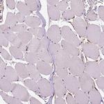 PHGDH Antibody in Immunohistochemistry (Paraffin) (IHC (P))