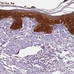 PHGDH Antibody in Immunohistochemistry (Paraffin) (IHC (P))