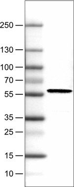 PHGDH Antibody in Western Blot (WB)