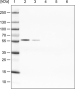 PHGDH Antibody in Western Blot (WB)