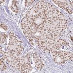 ERCC1 Antibody in Immunohistochemistry (Paraffin) (IHC (P))