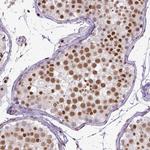 ERCC1 Monoclonal Antibody (CL1284)