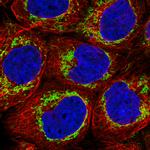 TUFM Antibody in Immunocytochemistry (ICC/IF)