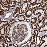 TUFM Antibody in Immunohistochemistry (Paraffin) (IHC (P))