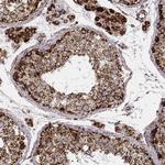 TUFM Antibody in Immunohistochemistry (Paraffin) (IHC (P))