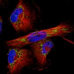 TUFM Antibody in Immunocytochemistry (ICC/IF)