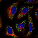 TUFM Antibody in Immunocytochemistry (ICC/IF)