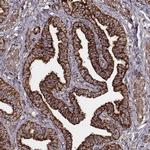 TUFM Antibody in Immunohistochemistry (Paraffin) (IHC (P))