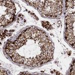 TUFM Antibody in Immunohistochemistry (Paraffin) (IHC (P))