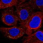 VPS26A Antibody in Immunocytochemistry (ICC/IF)