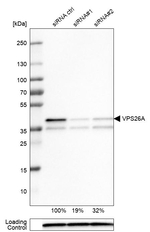 VPS26A Antibody in Western Blot (WB)