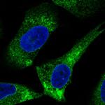 ERp57 Monoclonal Antibody (CL2444)