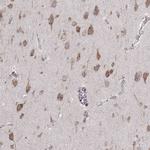 ERp57 Antibody in Immunohistochemistry (Paraffin) (IHC (P))